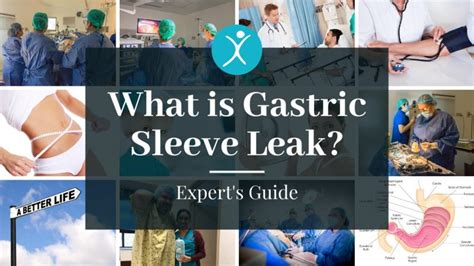 signs of gastric sleeve leak|How to Detect Common Gastric Sleeve Leak。